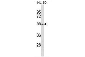 MGAT3 Antibody (C-term) western blot analysis in HL-60 cell line lysates (35µg/lane). (MGAT3 antibody  (C-Term))