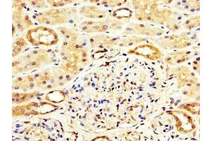 IHC image of ABIN7175838 diluted at 1:100 and staining in paraffin-embedded human kidney tissue performed on a Leica BondTM system. (WASF3 antibody  (AA 368-502))