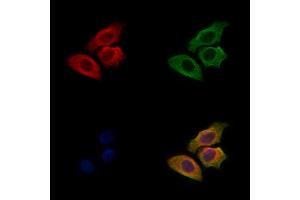 ABIN6262062 and ABIN6272310 staining Hela cells by IF/ICC.