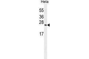 TIMP4 Antibody (Center) western blot analysis in Hela cell line lysates (35 µg/lane).