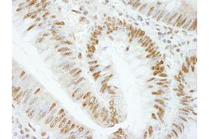 Immunohistochemistry (IHC) image for anti-RNA Binding Motif Protein 25 (RBM25) (AA 475-525) antibody (ABIN7448762) (RBM25 antibody  (AA 475-525))