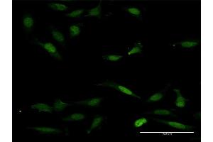 Immunofluorescence of purified MaxPab antibody to NFAT5 on HeLa cell. (NFAT5 antibody  (AA 1-1484))