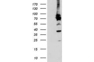 HEK293T cells were transfected with the pCMV6-ENTRY control (Left lane) or pCMV6-ENTRY PDIA4 (Right lane) cDNA for 48 hrs and lysed. (PDIA4 antibody)