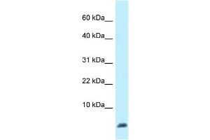 WB Suggested Anti-Ubl5 Antibody Titration: 1. (UBL5 antibody  (N-Term))