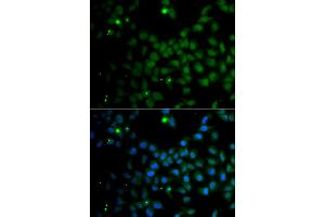 Immunofluorescence analysis of A549 cells using SMAD9 antibody. (SMAD9 antibody)
