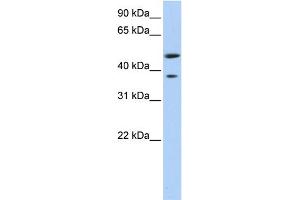 WB Suggested Anti-MAGEA3 Antibody Titration:  0. (MAGEA3 antibody  (Middle Region))
