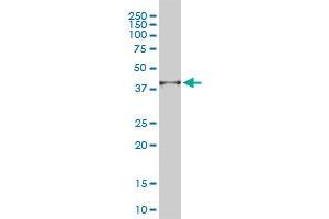 PSMD14 monoclonal antibody (M01), clone 4A10-E8 Western Blot analysis of PSMD14 expression in A-431 . (PSMD14 antibody  (AA 1-95))