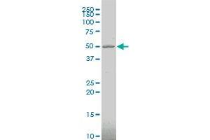STRADB polyclonal antibody (A01), Lot # 061025JCS1 Western Blot analysis of STRADB expression in HeLa . (STRADB antibody  (AA 1-95))