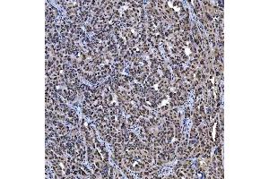 IHC analysis of SAE1 using anti-SAE1 antibody (ABIN7601346). (SAE1 antibody  (AA 33-299))
