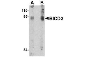 Image no. 1 for anti-Bicaudal D Homolog 2 (BICD2) (C-Term) antibody (ABIN342679) (BICD2 antibody  (C-Term))