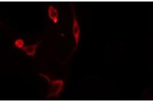 ABIN6276298 staining  Hela cells by IF/ICC. (Caspase 3 antibody  (N-Term))