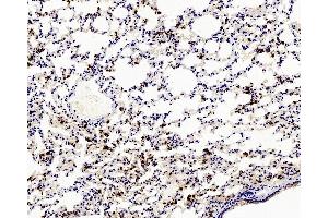 Immunohistochemistry analysis of paraffin-embedded mouse Inflammatory lung using Ly6g Polyclonal Antibody at dilution of 1:200. (Ly6g antibody)