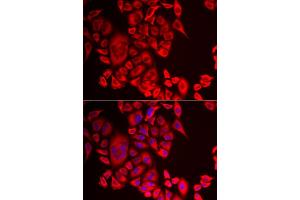 Immunofluorescence analysis of MCF-7 cells using QPCT antibody (ABIN5974054).