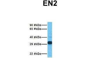 Host:  Rabbit  Target Name:  EN2  Sample Tissue:  Human Jurkat  Antibody Dilution:  1. (EN2 antibody  (C-Term))