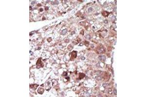 Image no. 2 for anti-phosphoenolpyruvate Carboxykinase 1 (Soluble) (PCK1) (N-Term) antibody (ABIN360565) (PCK1 antibody  (N-Term))