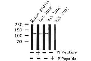 Western blot analysis of Phospho-FAK (Tyr397) expression in various lysates (FAK antibody  (pTyr397))