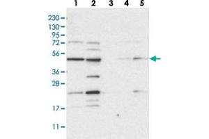 Western blot analysis of Lane 1: RT-4, Lane 2: U-251 MG, Lane 3: Human Plasma, Lane 4: Liver, Lane 5: Tonsil with NAPEPLD polyclonal antibody  at 1:250-1:500 dilution. (NAPEPLD antibody)