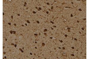 ABIN6276475 at 1/100 staining Rat brain tissue by IHC-P. (PSMD4/ASF antibody  (Internal Region))
