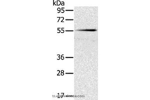 Western blot analysis of Mouse pancreas tissue, using SLC16A10 Polyclonal Antibody at dilution of 1:200 (SLC16A10 antibody)