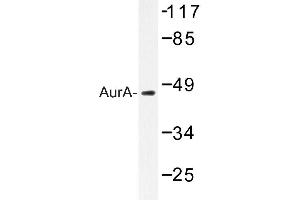 Image no. 1 for anti-Aurora Kinase A (AURKA) antibody (ABIN272125) (Aurora A antibody)