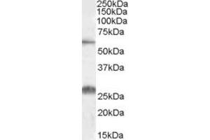 Western Blotting (WB) image for anti-Solute Carrier Family 47, Member 1 (SLC47A1) (AA 528-541) antibody (ABIN490521) (SLC47A1 antibody  (AA 528-541))
