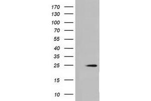 HEK293T cells were transfected with the pCMV6-ENTRY control (Left lane) or pCMV6-ENTRY MOBKL2B (Right lane) cDNA for 48 hrs and lysed. (MOBKL2B antibody)