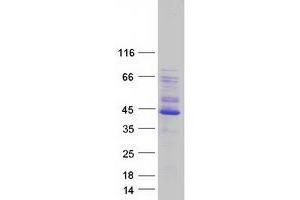 Validation with Western Blot