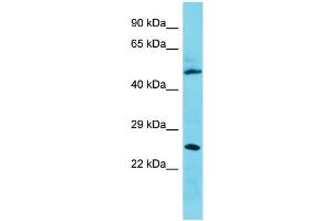 Host: Rabbit Target Name: C3orf26 Sample Type: 721_B Whole Cell lysates Antibody Dilution: 1. (CMSS1 antibody  (N-Term))
