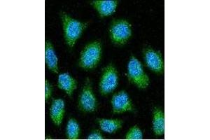 GDH Antibody (N-term) 7873a confocal immunofluorescent analysis with Hela cell. (GAPDH antibody  (N-Term))