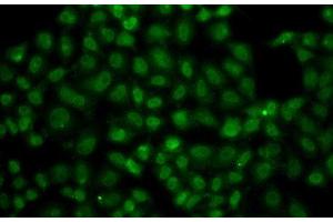 Immunofluorescence analysis of A549 cells using USP26 Polyclonal Antibody (USP26 antibody)