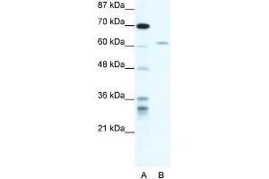 Human HepG2; WB Suggested Anti-ZNFN1A4 Antibody Titration: 1. (IKZF4 antibody  (N-Term))