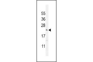 UTS2 Antibody (N-term) (ABIN392523 and ABIN2842080) western blot analysis in WiDr cell line lysates (35 μg/lane). (Urotensin 2 antibody  (N-Term))