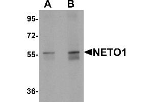 Western blot analysis of NETO1 in human lung tissue lysate with NETO1 antibody at (A) 1 and (B) 2 µg/mL. (NETO1 antibody  (C-Term))