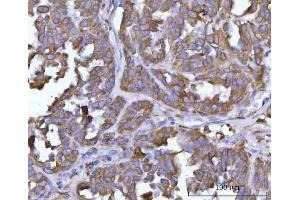 IHC analysis of ERP29 using anti-ERP29 antibody (ABIN7601342).