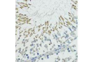 Immunohistochemistry of paraffin-embedded rat testis using TRIP12 antibody (ABIN6129753, ABIN6149543, ABIN6149544 and ABIN6225295) at dilution of 1:100 (40x lens).