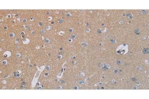 Immunohistochemistry of paraffin-embedded Human brain tissue using HSD3B7 Polyclonal Antibody at dilution 1:40 (HSD3B7 antibody)