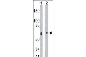Antibody is used in Western blot to detect CERK in mouse heart tissue lysate (Lane 1) and A2058 cell lysate (Lane 2). (CERK antibody  (C-Term))