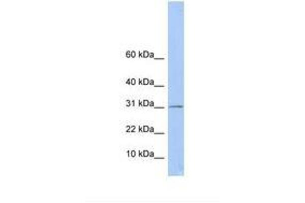 ECHDC1 antibody  (AA 74-123)
