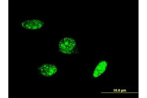 Immunofluorescence of monoclonal antibody to PAX8 on HeLa cell. (PAX8 antibody  (AA 1-450))