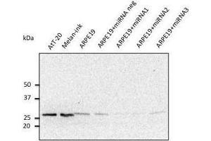 Anti. (RAB27A antibody  (C-Term))