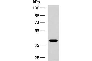 Western blot analysis of HepG2 cell lysate using PLPPR5 Polyclonal Antibody at dilution of 1:1500 (LPPR5 antibody)