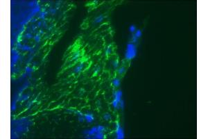 Immunofluorescence staining of a 9 days old zebrafish embryo (Desmin K5 antibody)