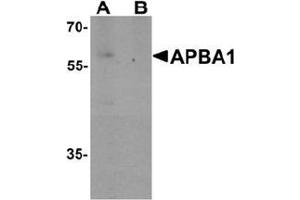 Western blot analysis of APBA1 in rat brain tissue lysate with APBA1 Antibody  at 0. (APBA1 antibody  (N-Term))