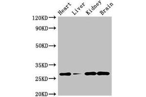 Western Blot Positive WB detected in: Mouse heart tissue, Mouse liver tissue, Mouse kidney tissue, Mouse brain tissue All lanes: GUCD1 antibody at 4 μg/mL Secondary Goat polyclonal to rabbit IgG at 1/50000 dilution Predicted band size: 28, 34 kDa Observed band size: 28 kDa