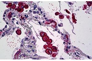 Human Lung, Macrophages: Formalin-Fixed, Paraffin-Embedded (FFPE) (Mannose Receptor antibody  (AA 22-131))