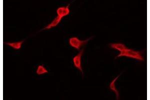 ABIN6274940 staining HuvEc by IF/ICC. (Calpain 9 antibody  (Internal Region))