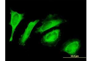Immunofluorescence of purified MaxPab antibody to C14orf114 on HeLa cell. (EXD2 antibody  (AA 1-496))