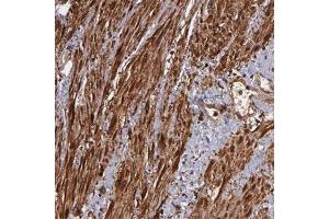 Immunohistochemical staining (Formalin-fixed paraffin-embedded sections) of human skeletal muscle with VCL polyclonal antibody  shows sstrong cytoplasmic positivity in smooth muscle cells at 1:50 - 1:200 dilution. (Vinculin antibody)
