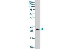 STMN2 monoclonal antibody (M06), clone 2G11 Western Blot analysis of STMN2 expression in IMR-32 . (STMN2 antibody  (AA 73-179))