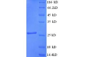 SDS-PAGE (SDS) image for Synaptosomal-Associated Protein, 25kDa (SNAP25) (AA 1-206), (full length) protein (His tag) (ABIN5710384) (SNAP25 Protein (AA 1-206, full length) (His tag))